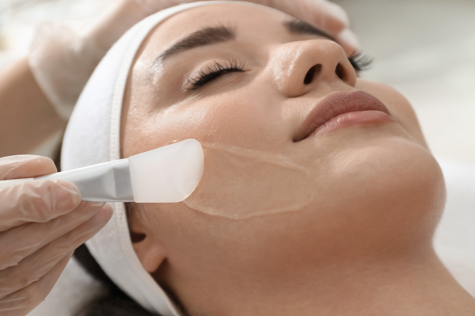 Chemical Peels
