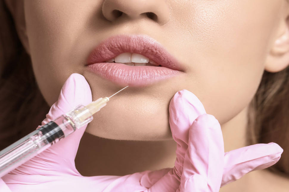 Dermal Fillers
