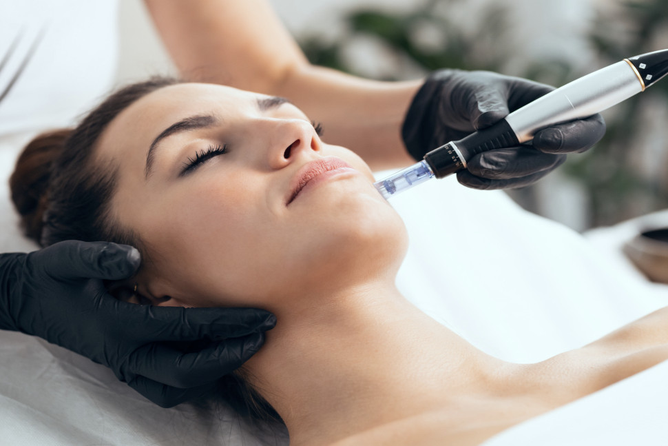 Microneedling