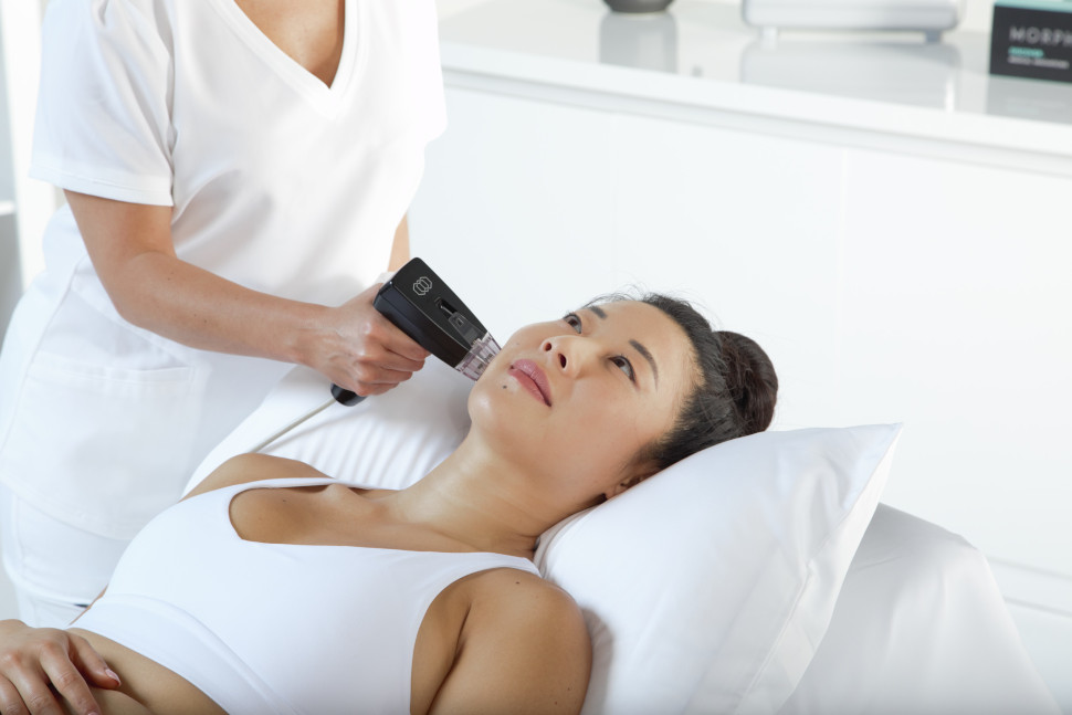 Morpheus8 - RF Microneedling